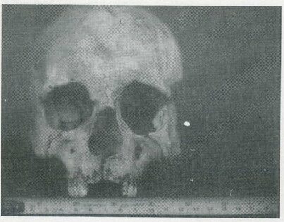 A black and white photograph of a skull
